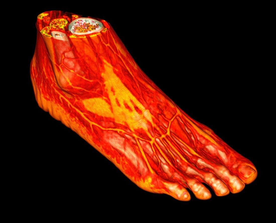 Human ankle and foot, 3D CT scan