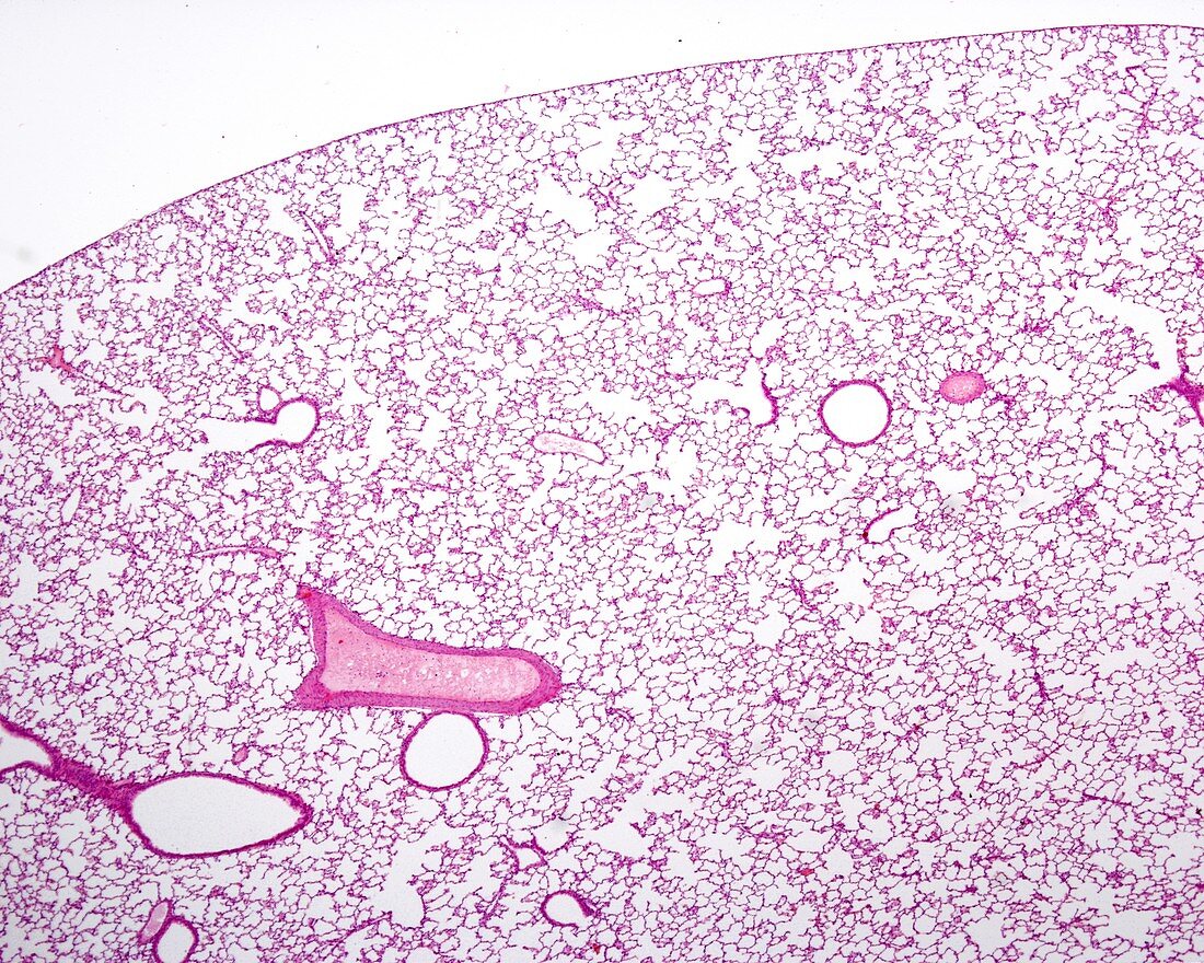 Lung parenchyma, light micrograph