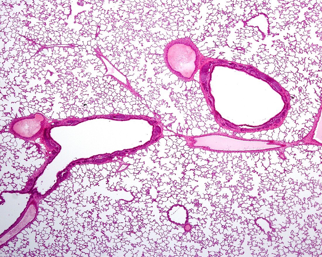 Lung parenchyma, light micrograph