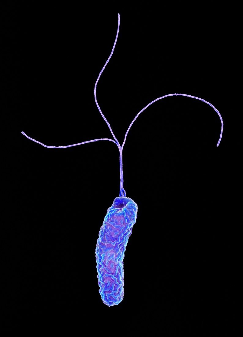 Helicobacter pylori bacterium, SEM