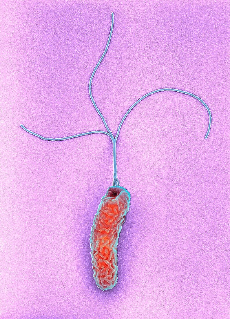 Helicobacter pylori bacterium, SEM