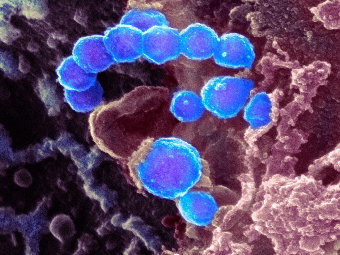 Chikungunya virus particles, SEM