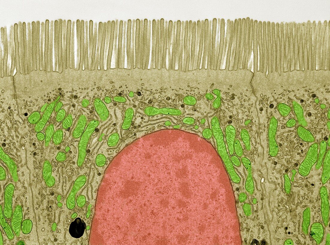 Intestinal epithelial cell, TEM