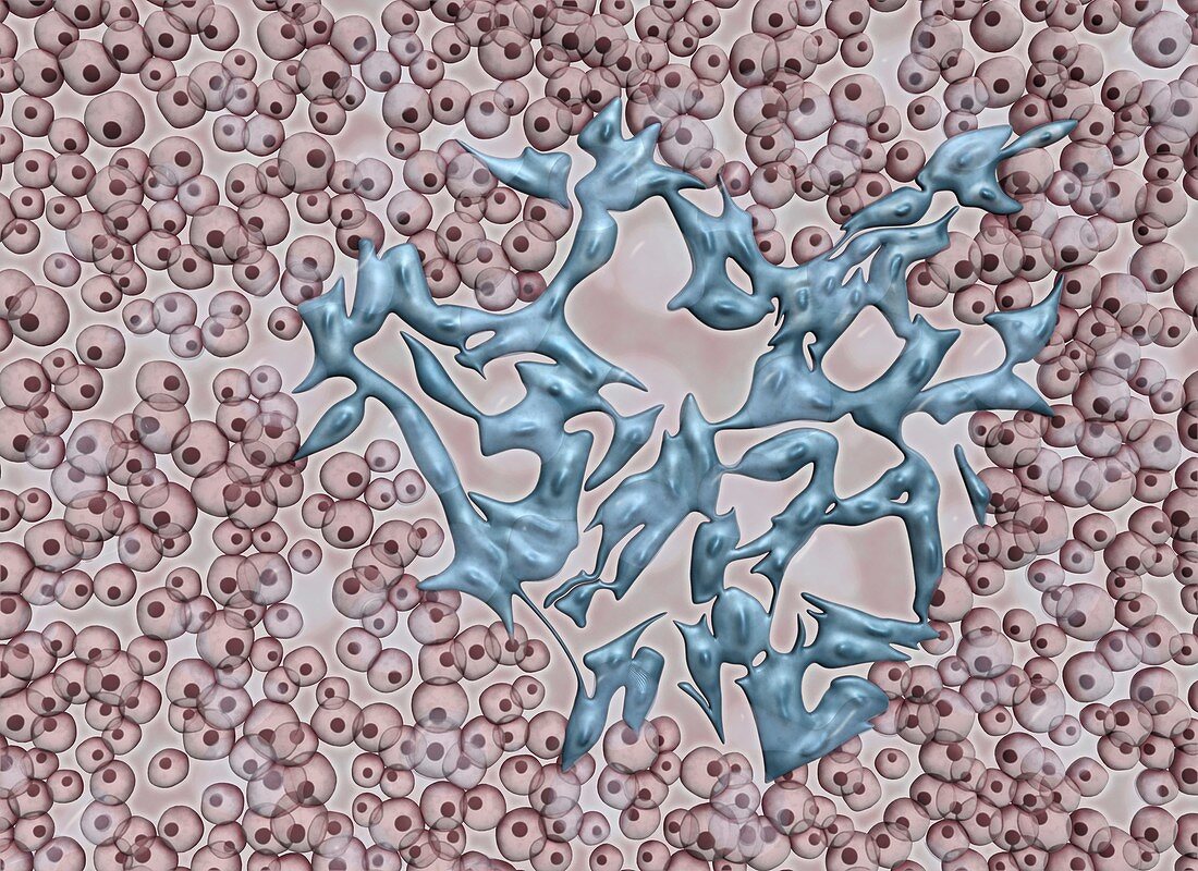 Melanoma cancer cell, illustration