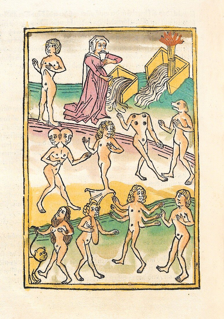 Deformities and diseases, 15th century