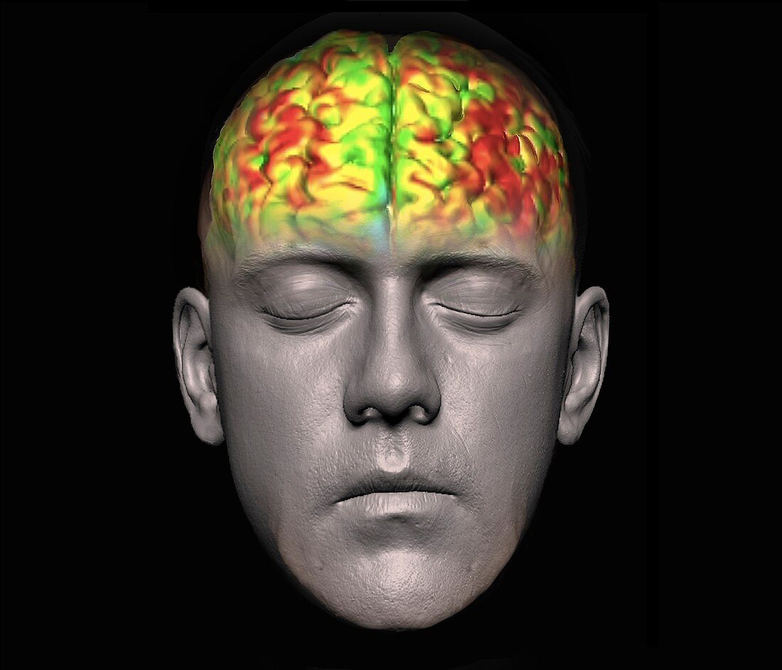 Human brain, fMRI scan
