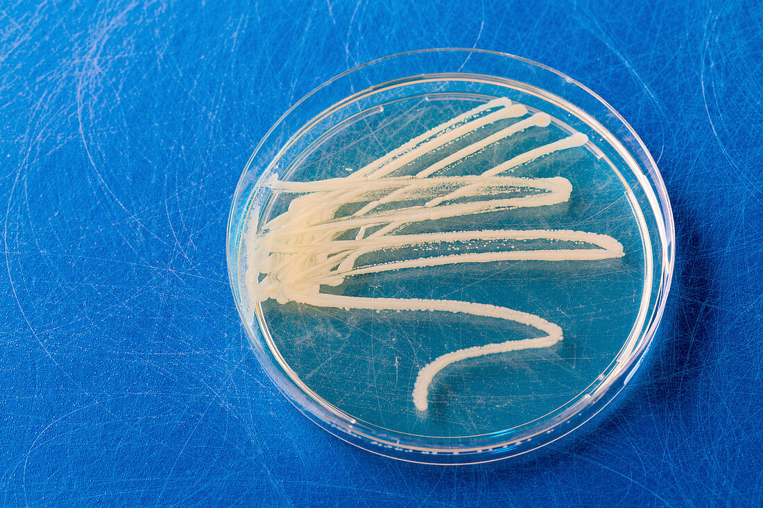 Cultures growing on Petri dish