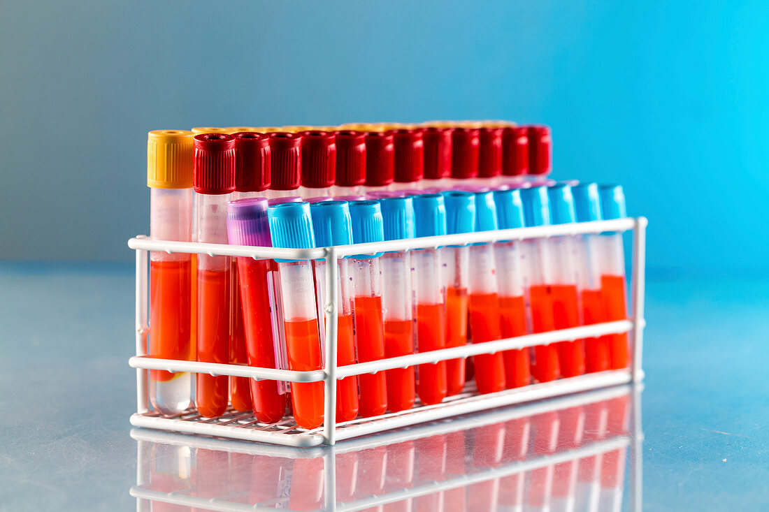 Blood samples in a lab