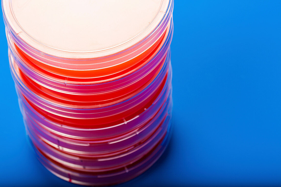 Petri dishes with blood agar