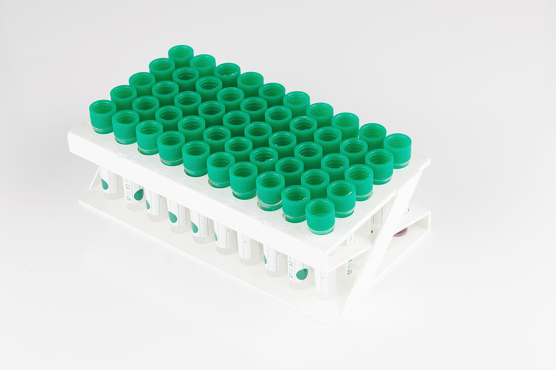 Plastic test tubes in rack