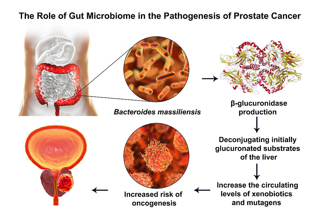 Gut microbiome and prostate cancer, conceptual illustration