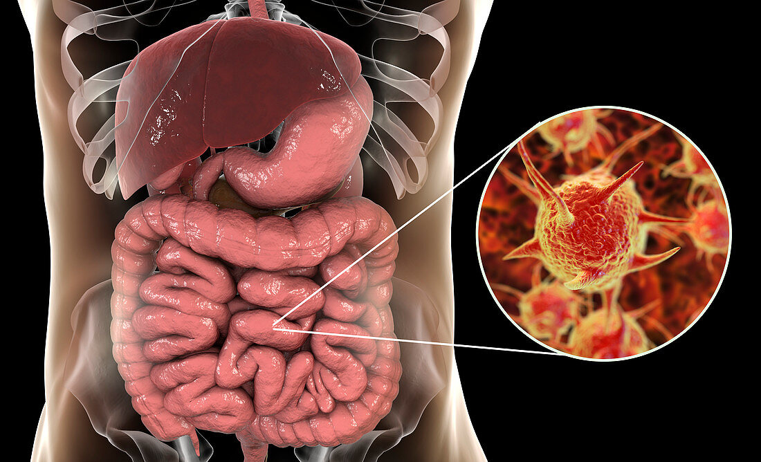 Parasitic microorganisms in human large intestine, illustrat