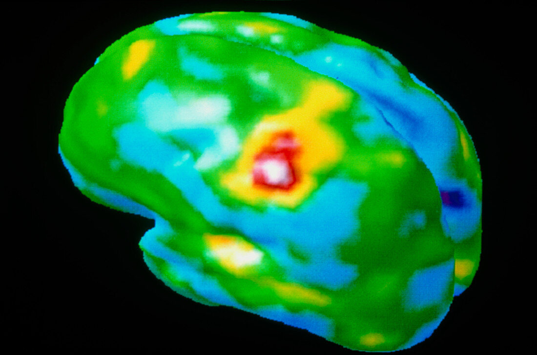 Coloured 3-D PET brain scan during a hand exercise