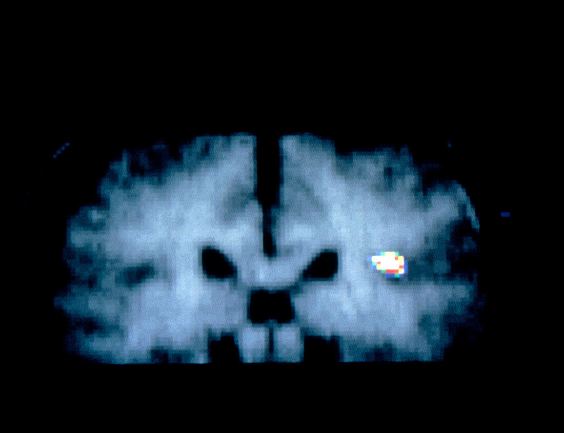 Coloured PET brain scan during tasting