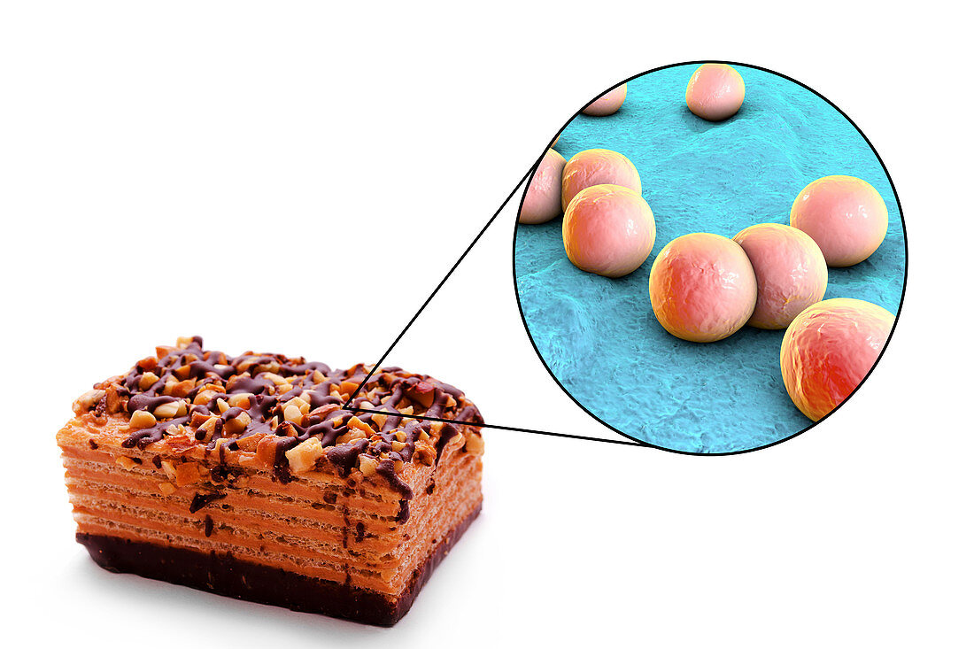 Staphylococcal food poisoning, conceptual illustration