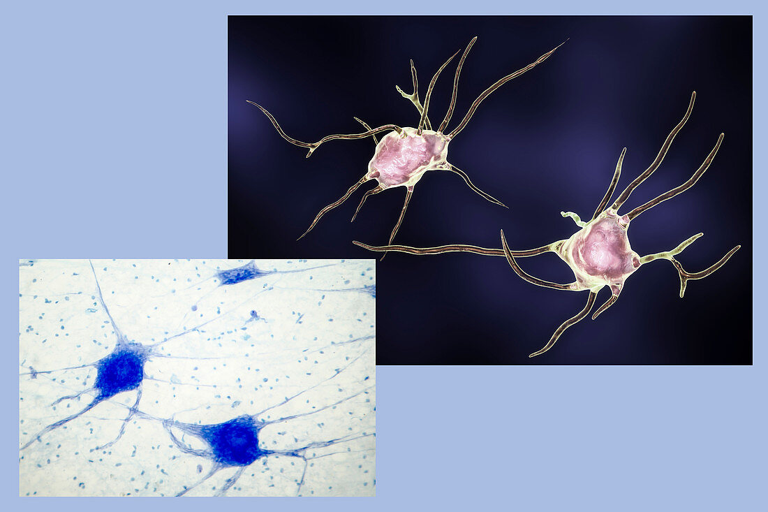 Nerve cells, computer illustration and micrograph