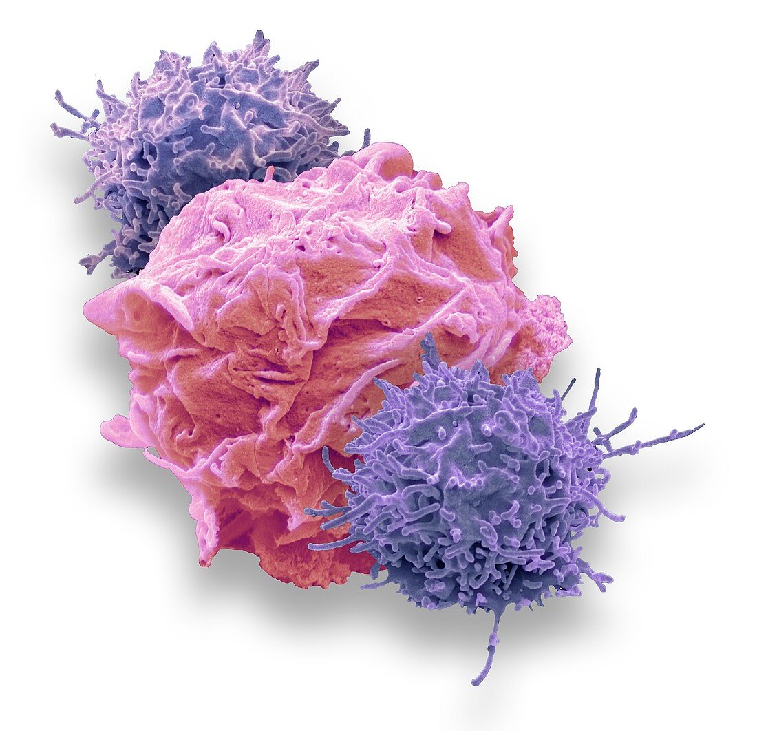 CAR T-cell immunotherapy, SEM