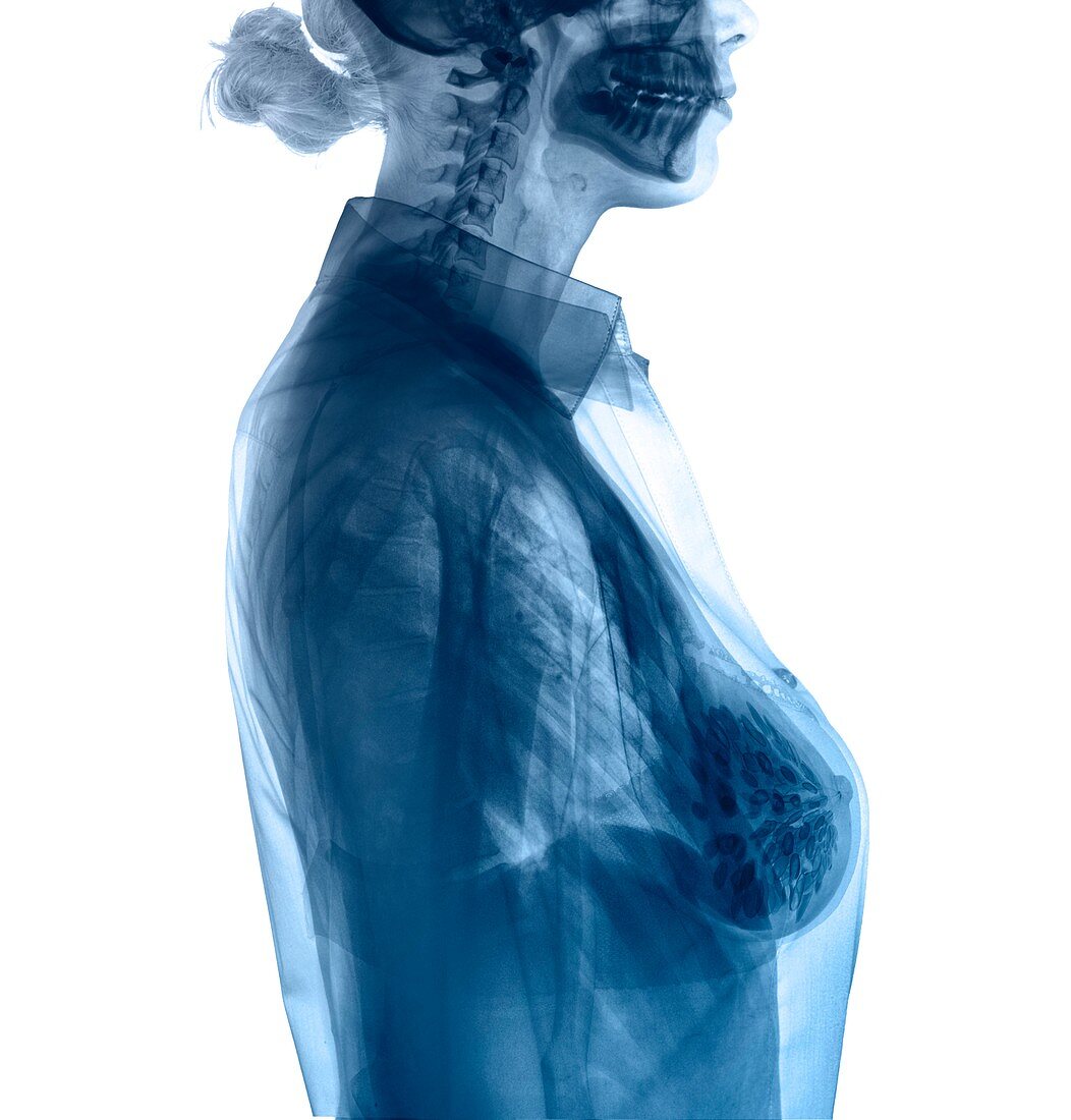 Woman's upper body, composite X-ray