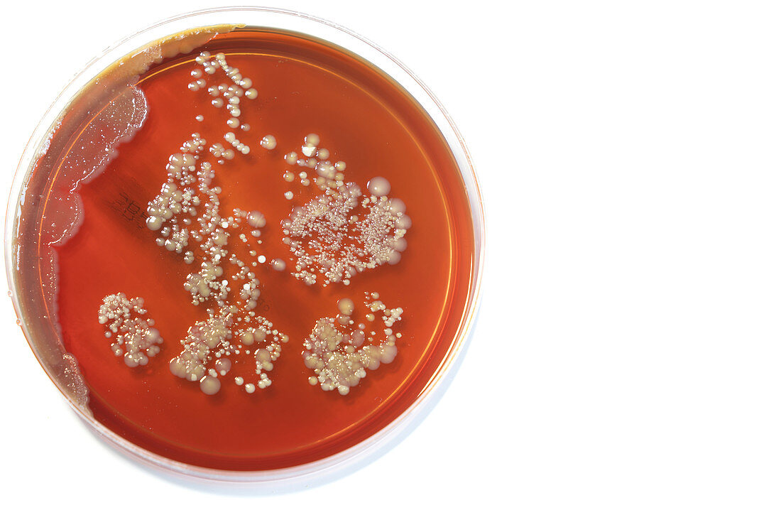 Microbes growing on agar plate