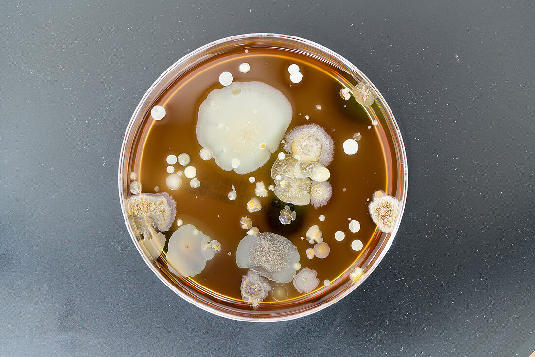 Microbes growing on agar plate