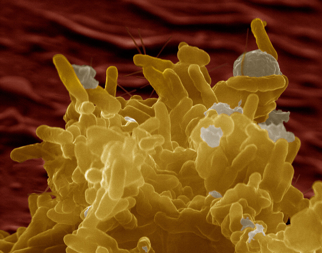 Enterobacter cloacae bacteria