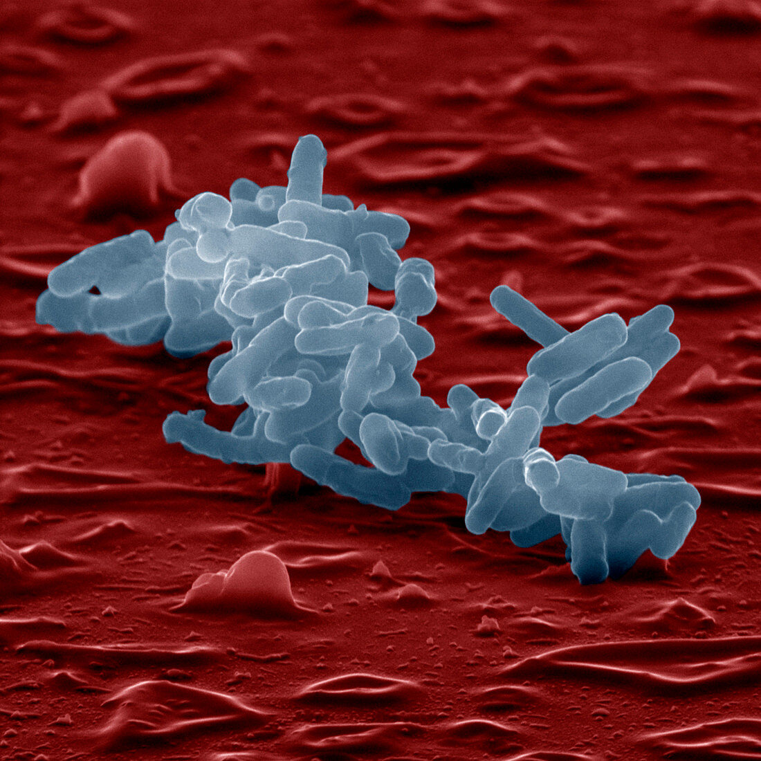 Enterobacter cloacae bacteria