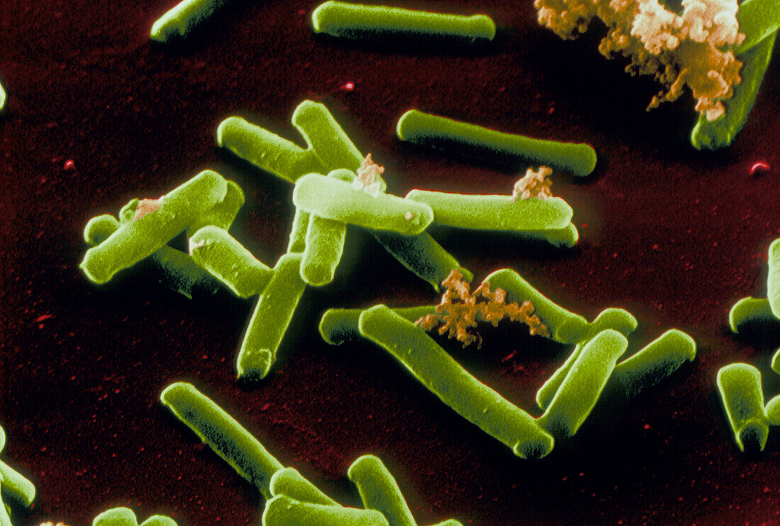 SEM of clostridium tetani bacteria
