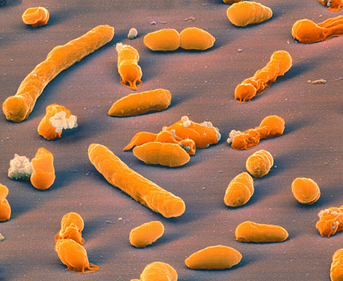 Klebsiella oxytoca bacteria