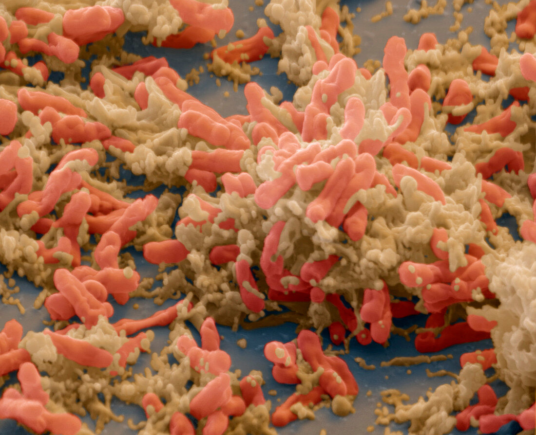 Mycobakt tuberkul 10000x - Tuberkulose-Bakterien