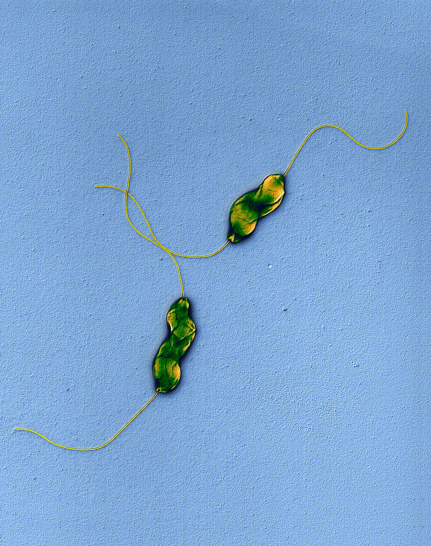 Campylob jejuni 16000x - Campylobacter jejuni