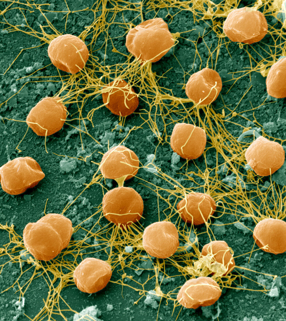 Pyrococcus furiosus archaea, SEM