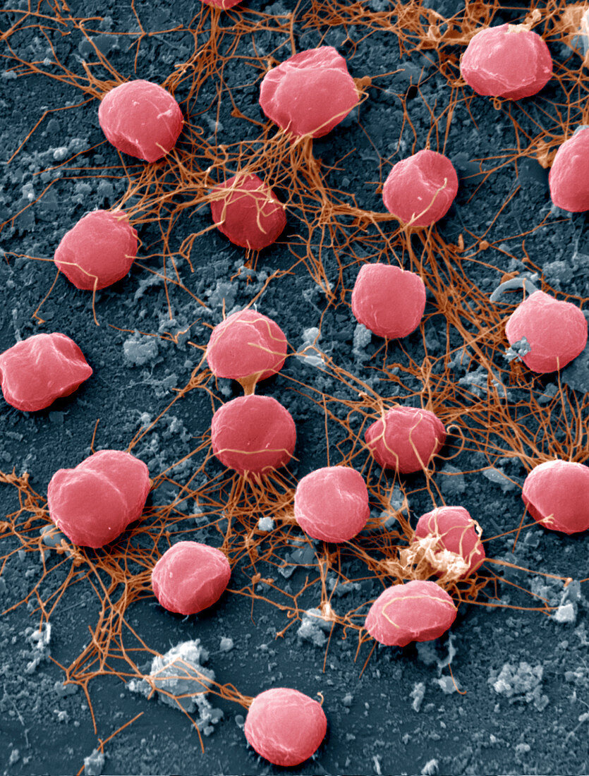 Pyrococcus furiosus 9000x - 