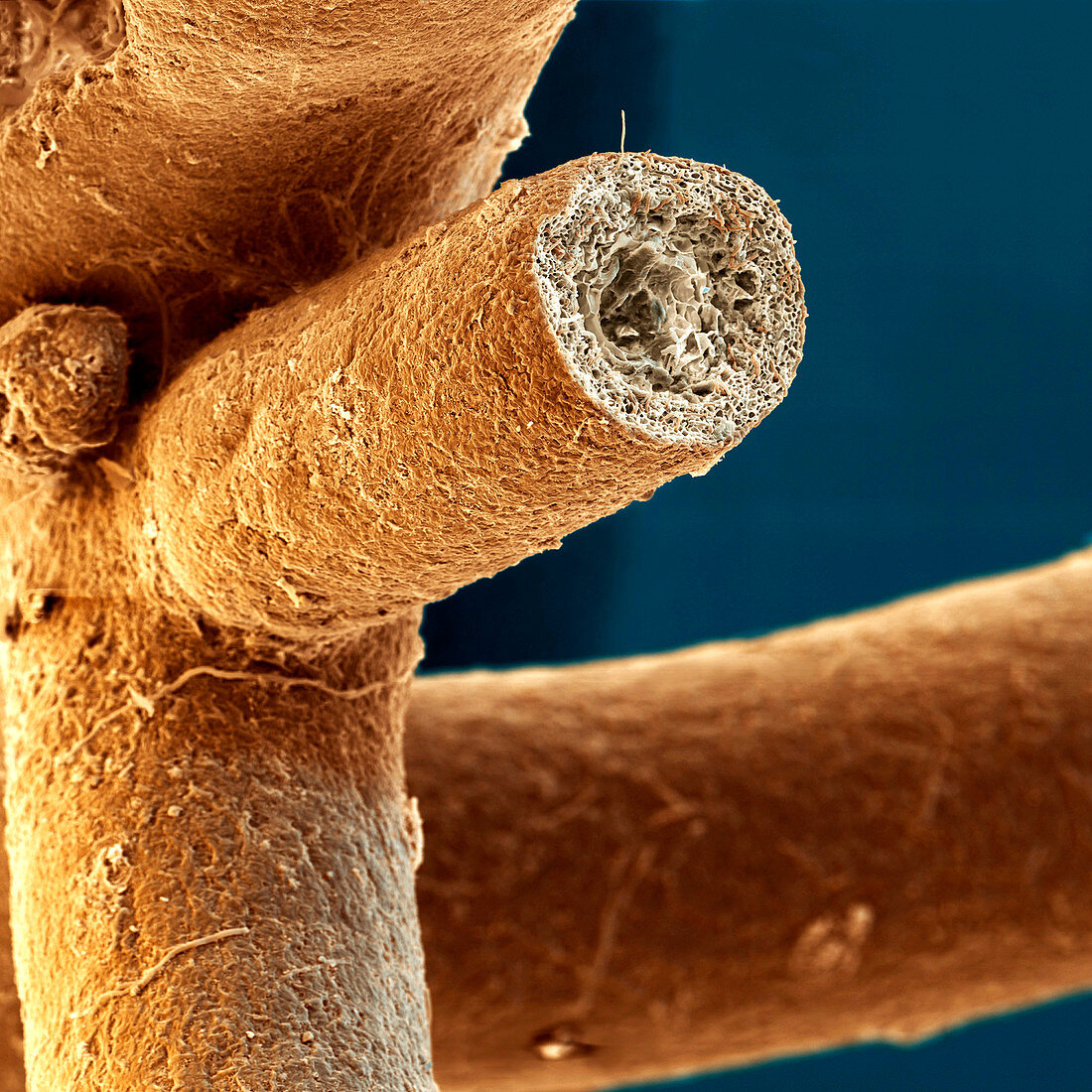 Mycorrhiza, SEM