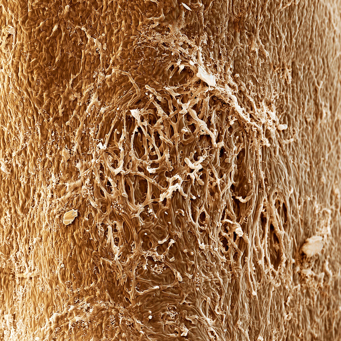 Mycorrhiza, SEM