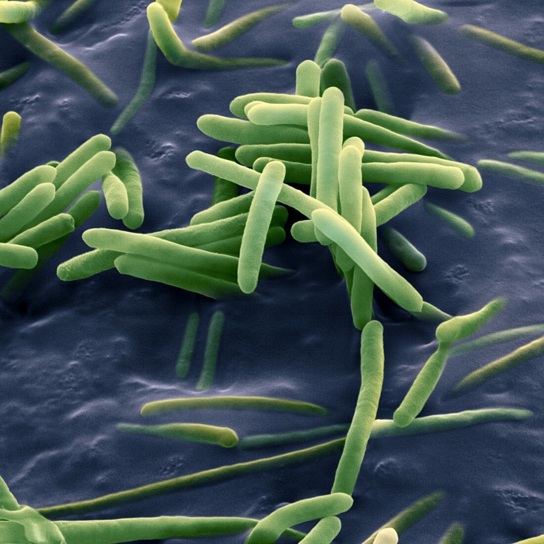 Bacillus sphaericus, SEM