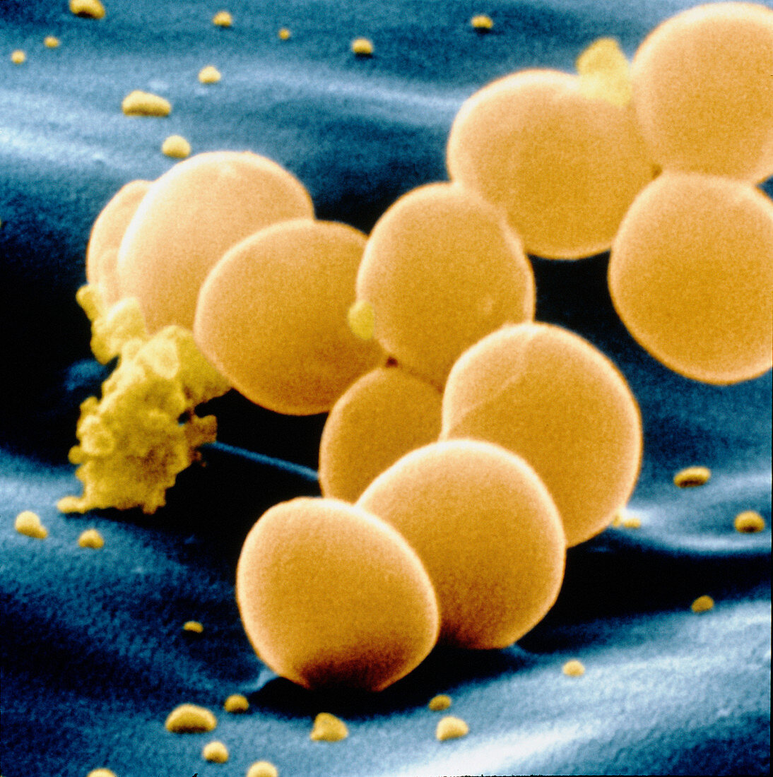 SEM of staphylococcus aureus bacteria