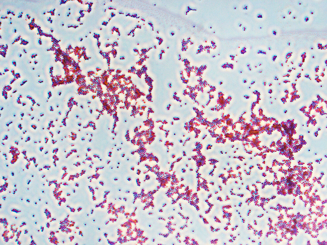 Staphyloc aureus PH 400x - Staphylococcus aureus 400x