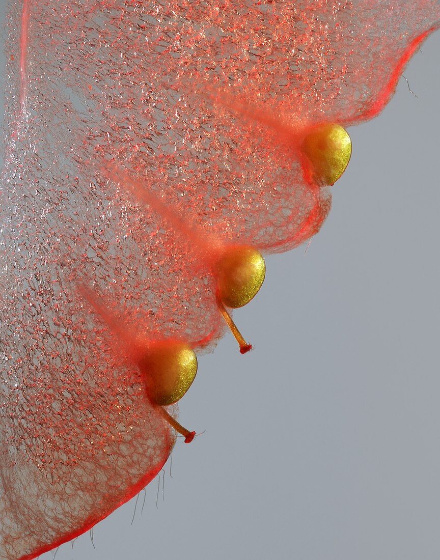 Strawberry seeds, light micrograph
