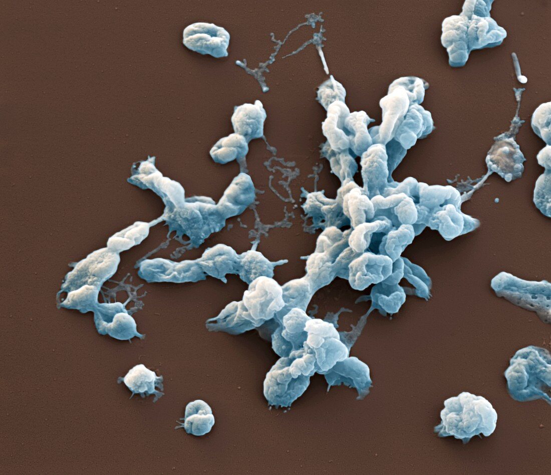 Francisella tular 22kx - Bakterien, Francisella tularensis 22 000-1