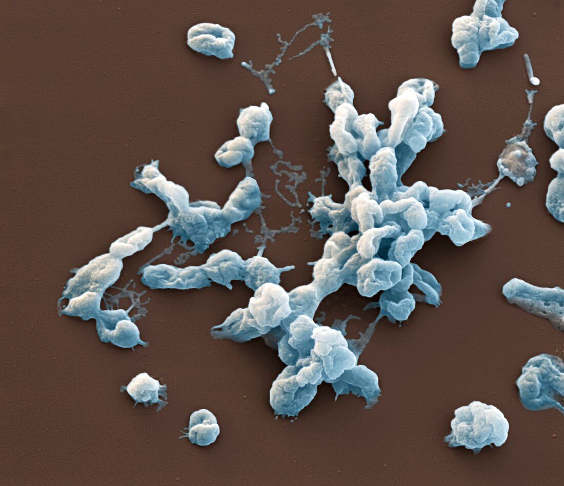 Francisella tularensis bacteria, SEM