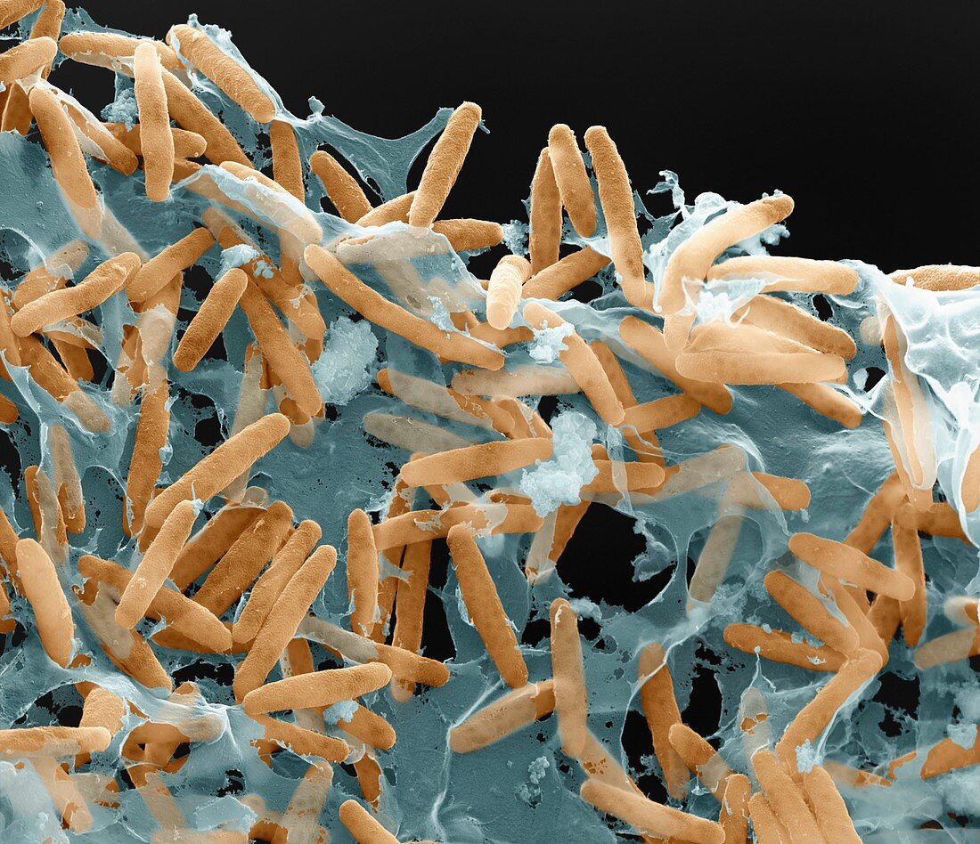 Myxococcus xanthus bacteria, SEM