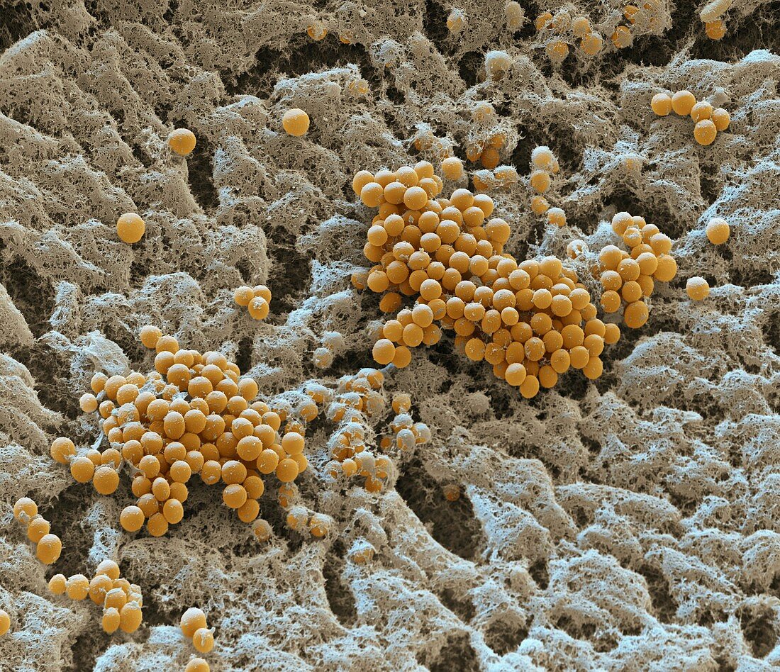 Myxococcus xanthus bacteria spores, SEM