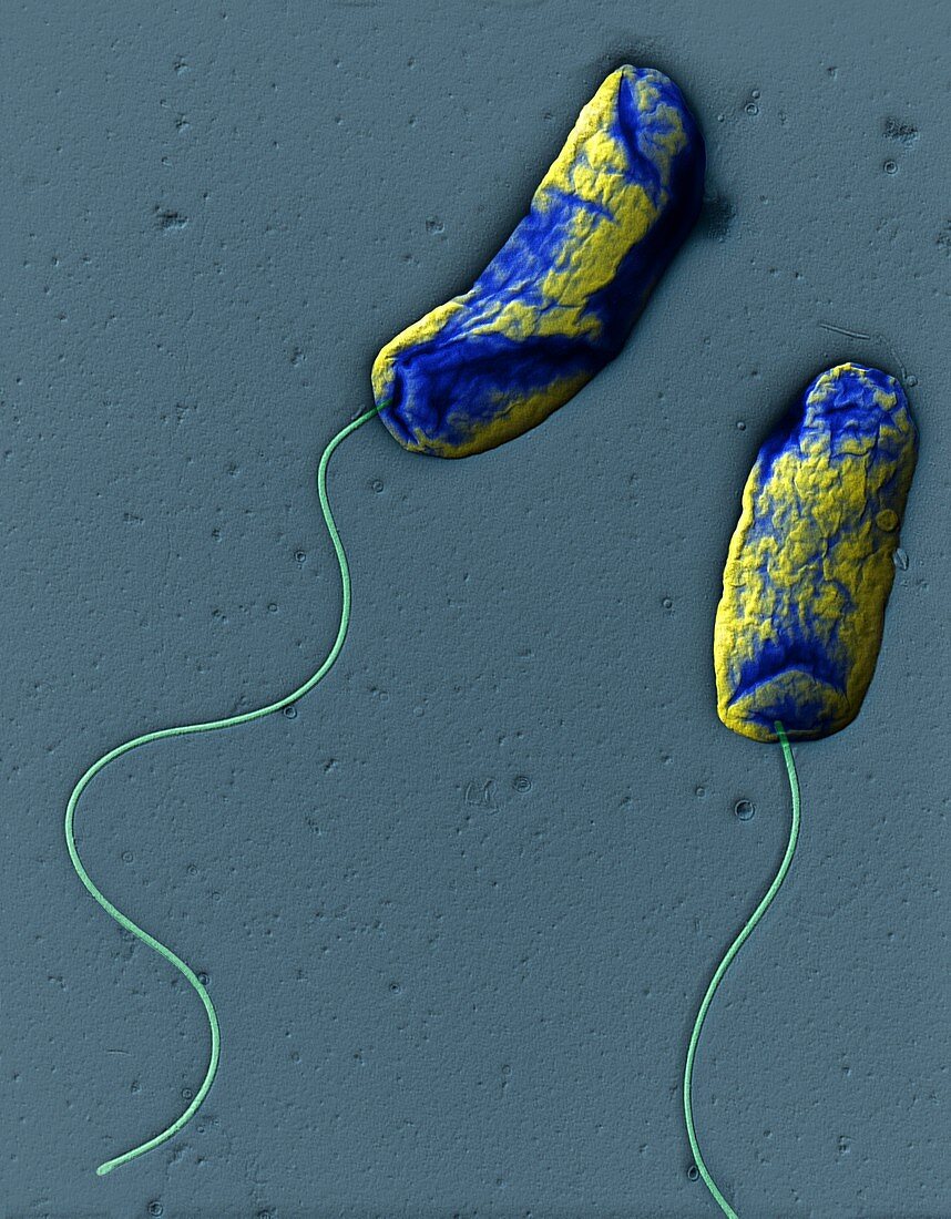 Cholera bacteria, TEM