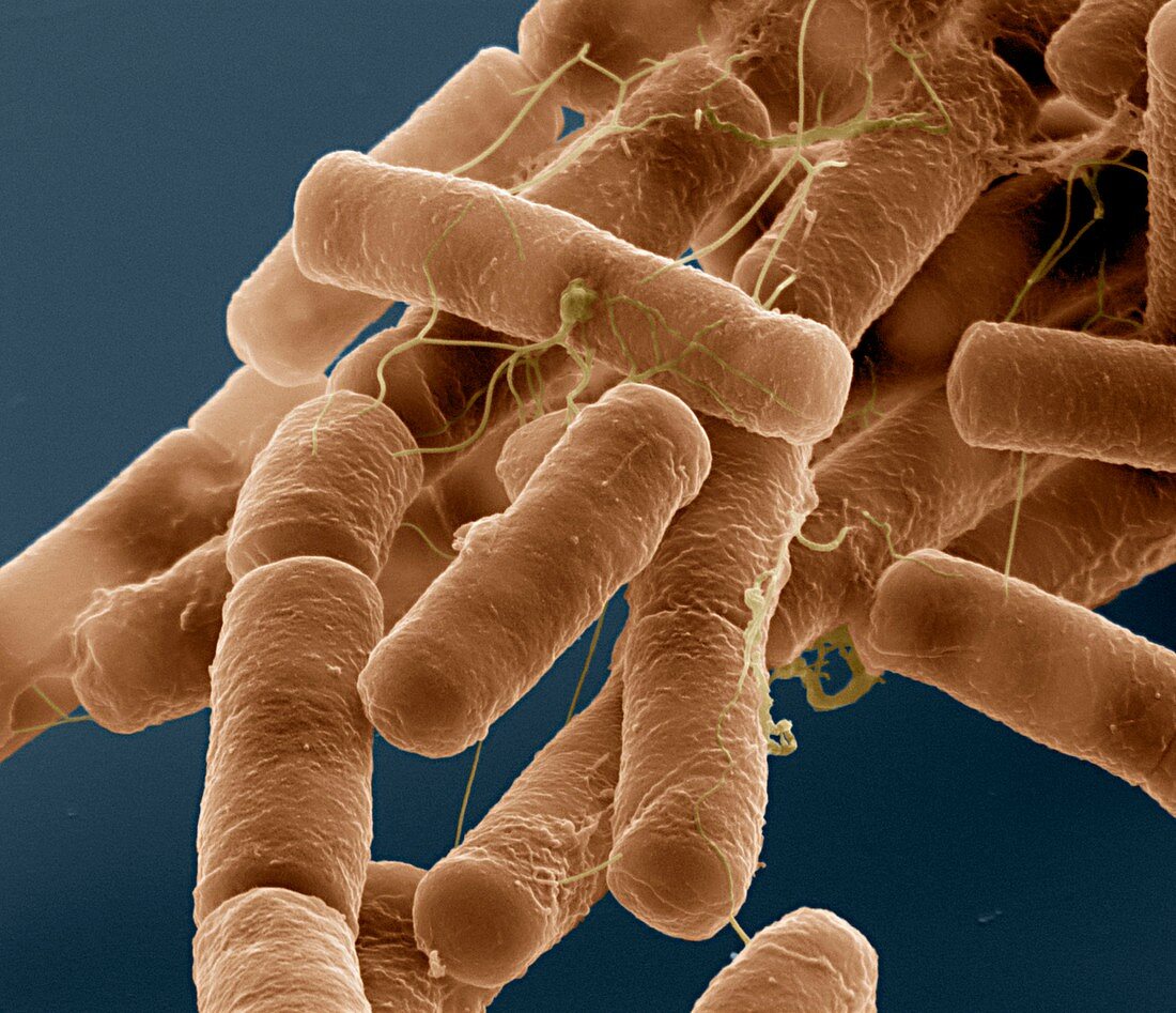 Bacillus cereus bacteria, SEM