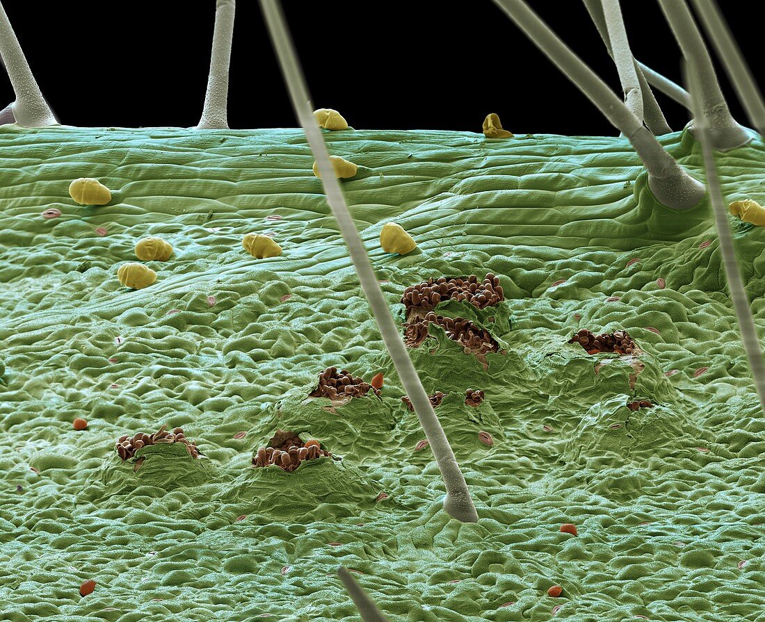 Leaf infected with rust fungus, SEM