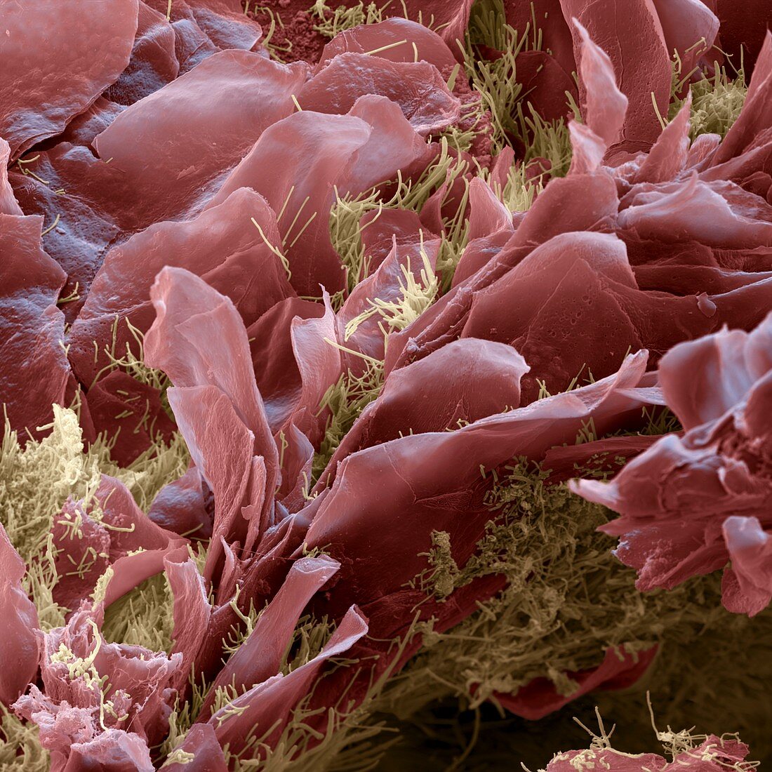 Human tongue surface with bacteria, SEM