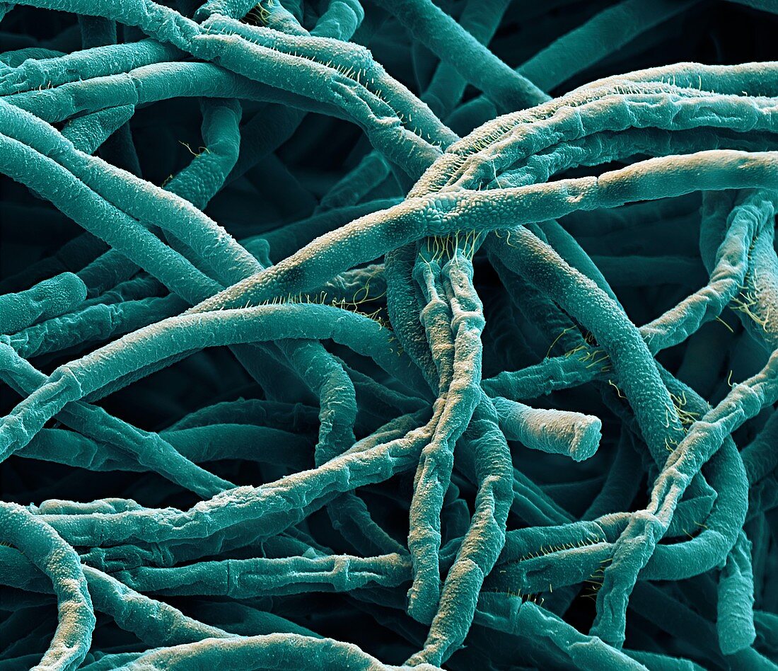 Anthrax bacteria, SEM