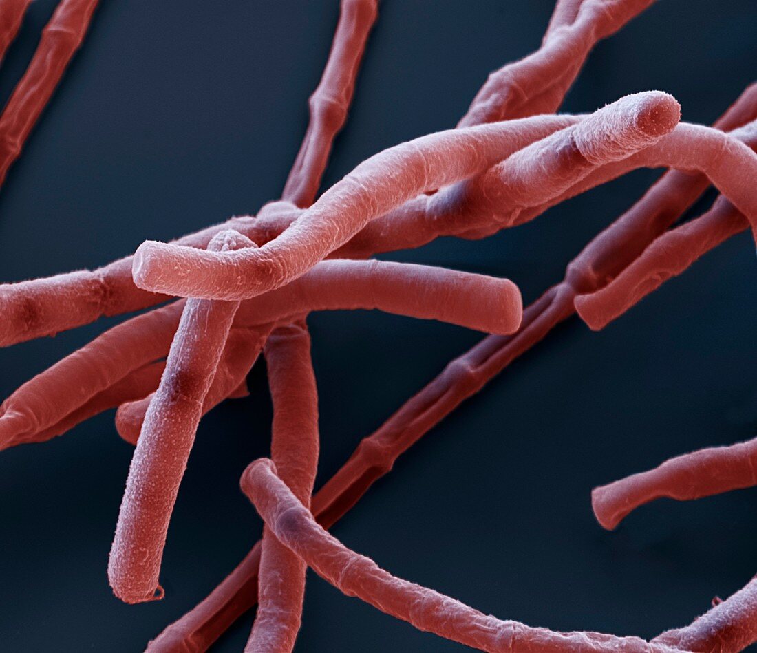 Bac anthracis 10000x - Bakterien, Bacillus anthracis, 10 000-1