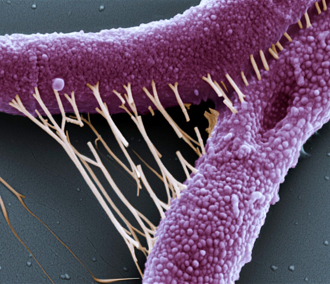 Bac anthracis 40kx - Bakterien, Bacillus anthracis, 40 000-1