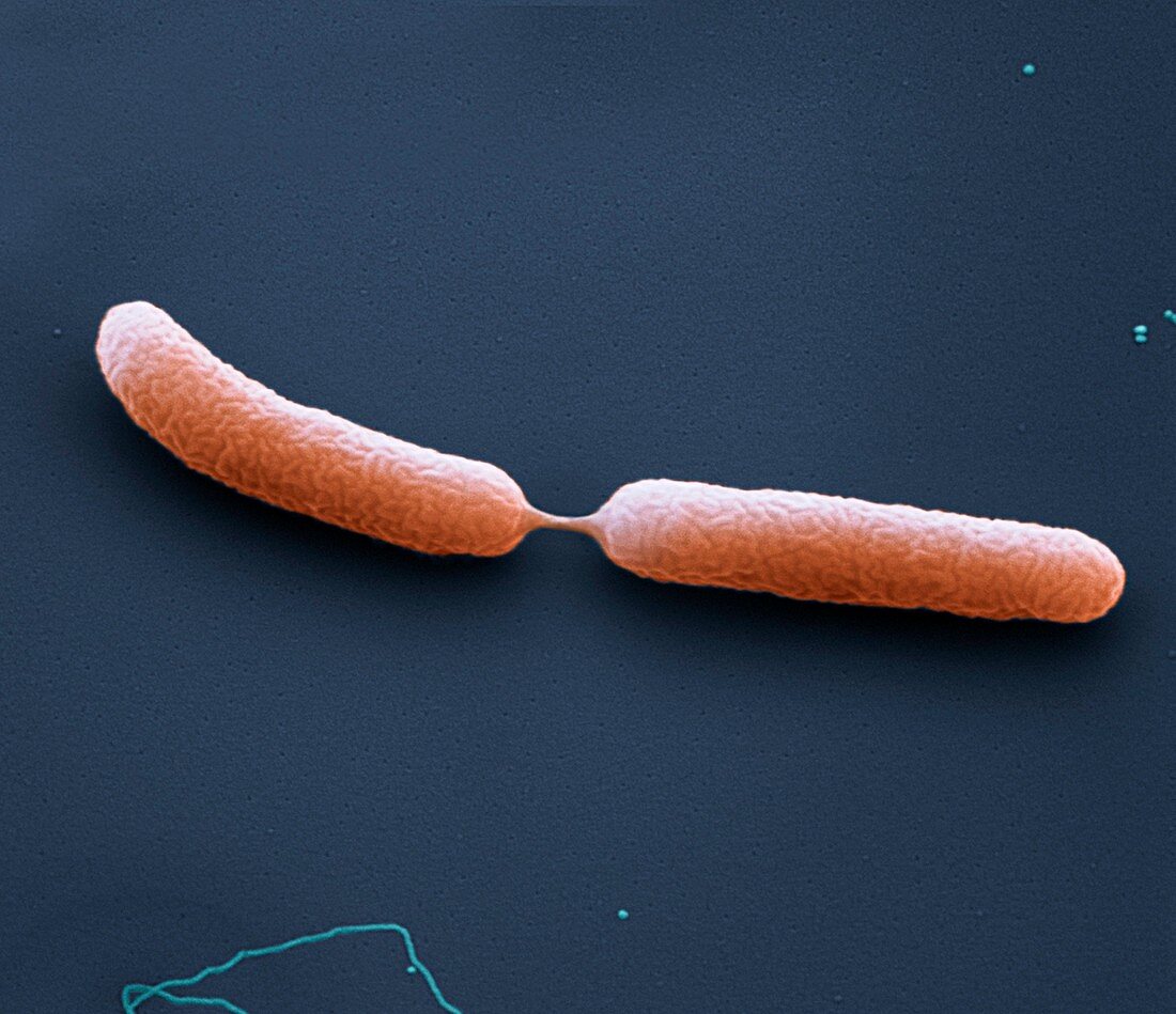 Burkholderi Teilung3  35kx - Bakterien, Burkholderi pseudomallei in Teilung 35 000-1